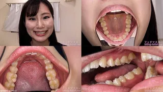 Mika - Watching Inside mouth of Japanese cute girl bite-207-1