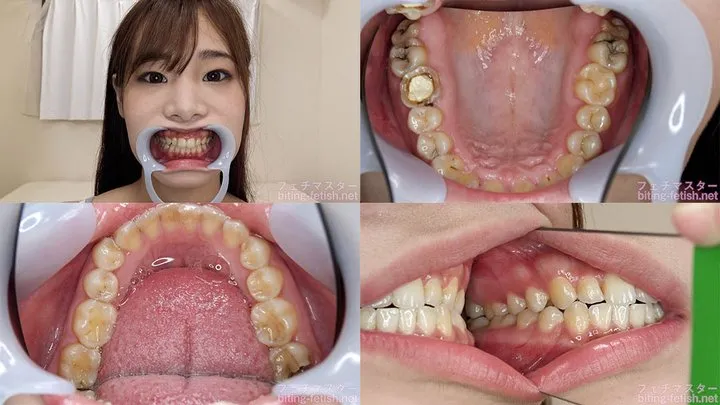 Rino - Watching Inside mouth of Japanese cute girl bite-208-1