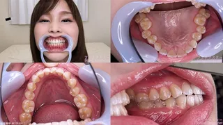 Sumire - Watching Inside mouth of Japanese cute girl bite-180-1
