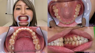 Kurumi - Watching Inside mouth of Japanese cute girl bite-184-1