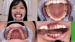 Nana - Watching Inside mouth of Japanese cute girl bite-192-1
