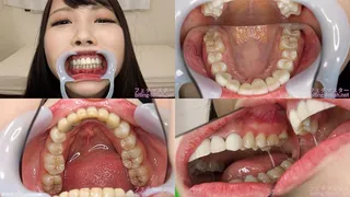 Kurumi - Watching Inside mouth of Japanese cute girl bite-193-1