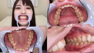 Satori - Watching Inside mouth of Japanese cute girl bite-172-1