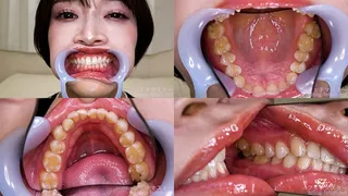 Sumire Tanba - Watching Inside mouth of Japanese cute girl