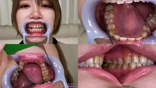 Yumeru Kotoishi - Watching Inside mouth of Japanese cute girl