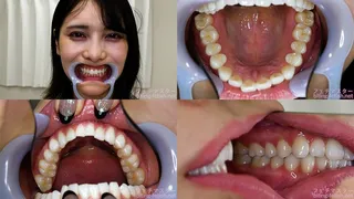 Mikana Mii - Watching Inside mouth of Japanese cute girl