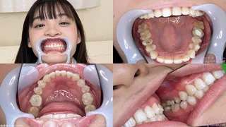 Urara - Watching Inside mouth of Japanese cute girl bite-264-1