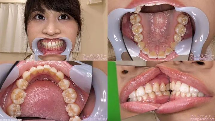 Shiori - Watching Inside mouth of Japanese cute girl bite-241-1