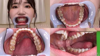 Ayaka - Watching Inside mouth of Japanese cute girl bite-243-1