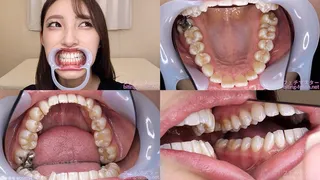 Kana - Watching Inside mouth of Japanese cute girl bite-238-1