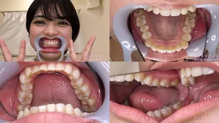 Noa - Watching Inside mouth of Japanese cute girl bite-258-1