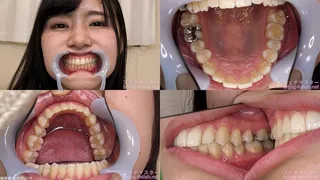 Maya - Watching Inside mouth of Japanese cute girl bite-252-1