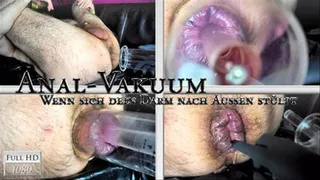 Anal vacuum - the guts turning upside down