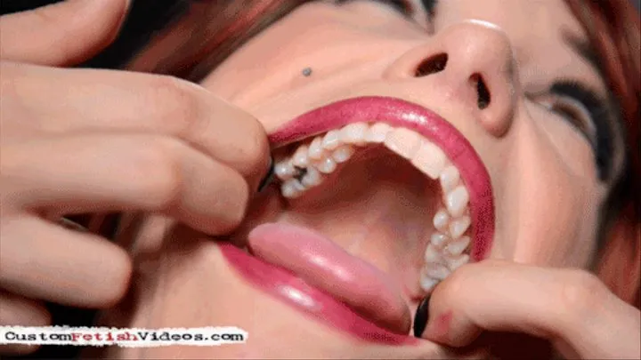 Raven Rae's Dental Problems [ ]