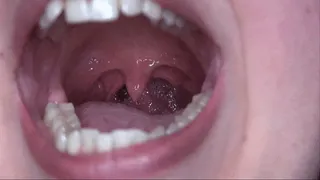 Uvula