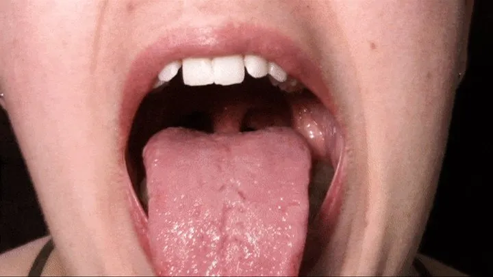 Hadley's Uvula and Mouth