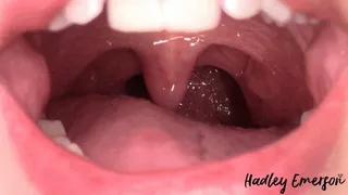 Dangling Uvula