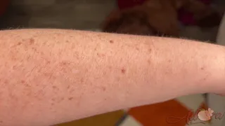 Arm Hair 2