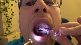 Candy Cane Mouth Examination