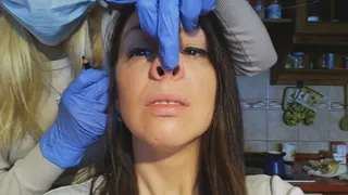 Pig nose - plastic surgery consultation