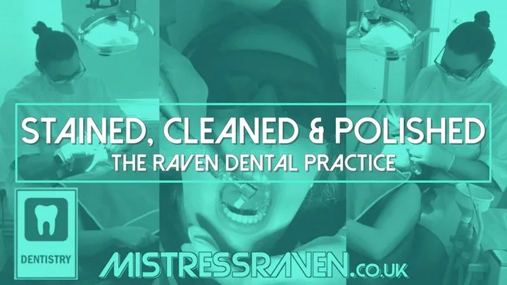 [939] Stained Cleaned and Polished The Raven Dental Practice