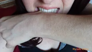 Bites on my arm