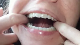 Bad teeth and fessured tongue