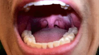 Early morning uvula