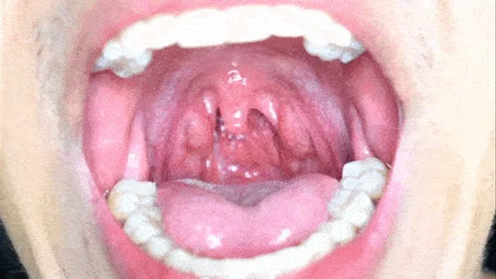 Exciting uvula