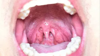 Uvula in the foreground - Collection 12