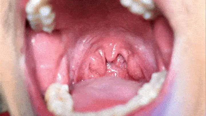 Christmas uvula