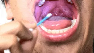 Touching the uvula with swabs