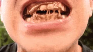 Chocolate on the teeth