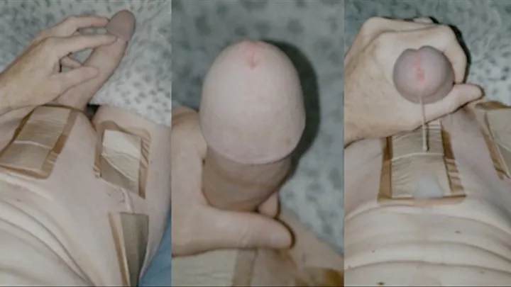 scar fetish - second post surgery masturbation with bandages