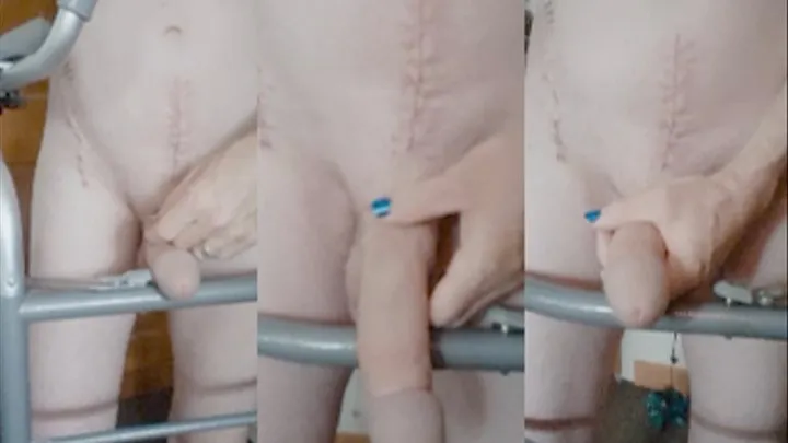 scar fetish - third post surgery masturbation withOUT bandages