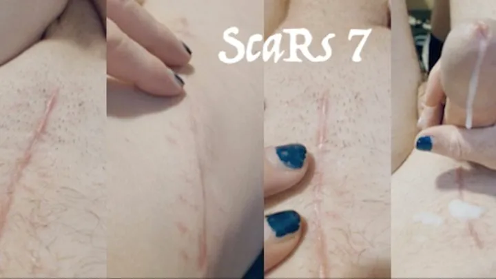 scar fetish 7 with masturbation