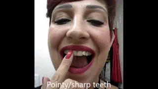 Pointy teeth, sharp teeth, vampire teeth...........