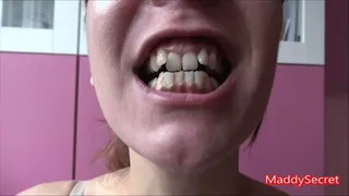 Sexy teeth [MADDALENA]