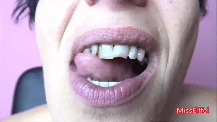 My mouth [IRIS]