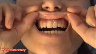 Sexy teeth [JESSICA]'