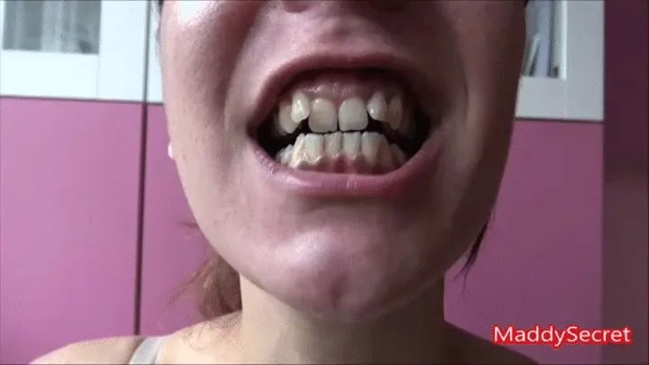 Sexy teeth [MADDALENA]'