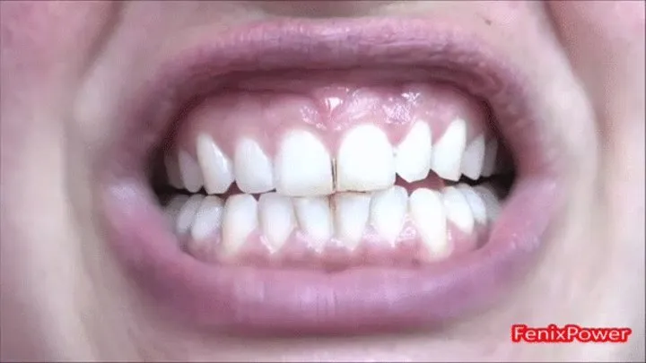 Zoe's teeth [ZOE]'