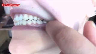 My teeth [ZOE]