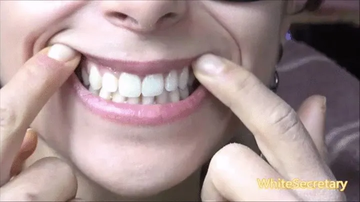 Strong teeth [JESSICA]*