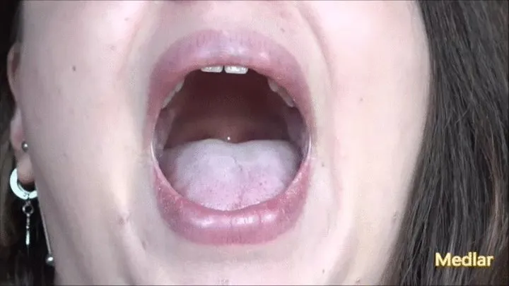 Tongue and uvula [HOPE]