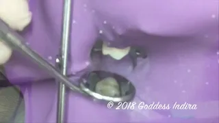 Oral Visit