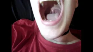 I want to show you my mouth