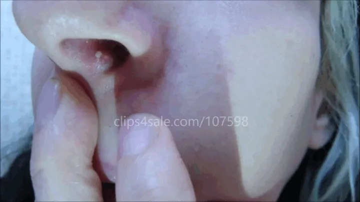 Nostril pimple popping!