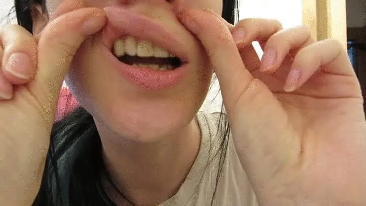 Receding gums and Invisalign