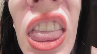 Mouth tour with Invisalign and gagging (close-up)